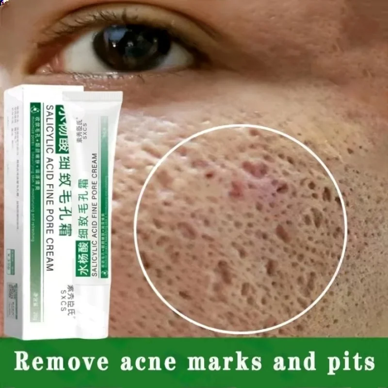 Salicylic Acid Blackhead Remover - Крем для очищения пор с салициловой