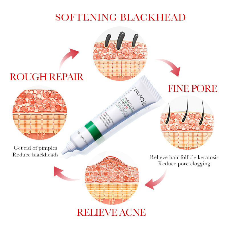 1/2/3 шт. BIOAQUA крем для лиц – обзор и цена Salicylic Acid Blackhead Remover