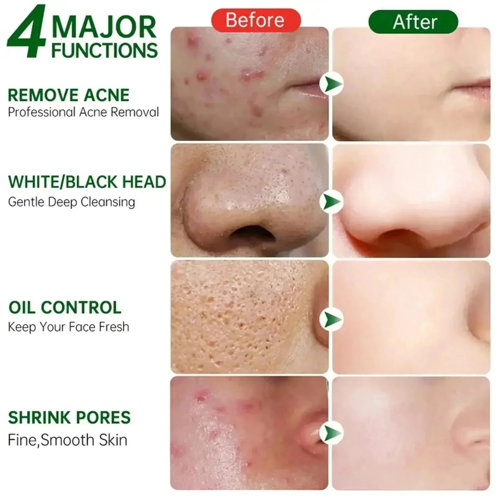 Крем для очищения пор с салици – обзор и цена Salicylic Acid Blackhead Remover