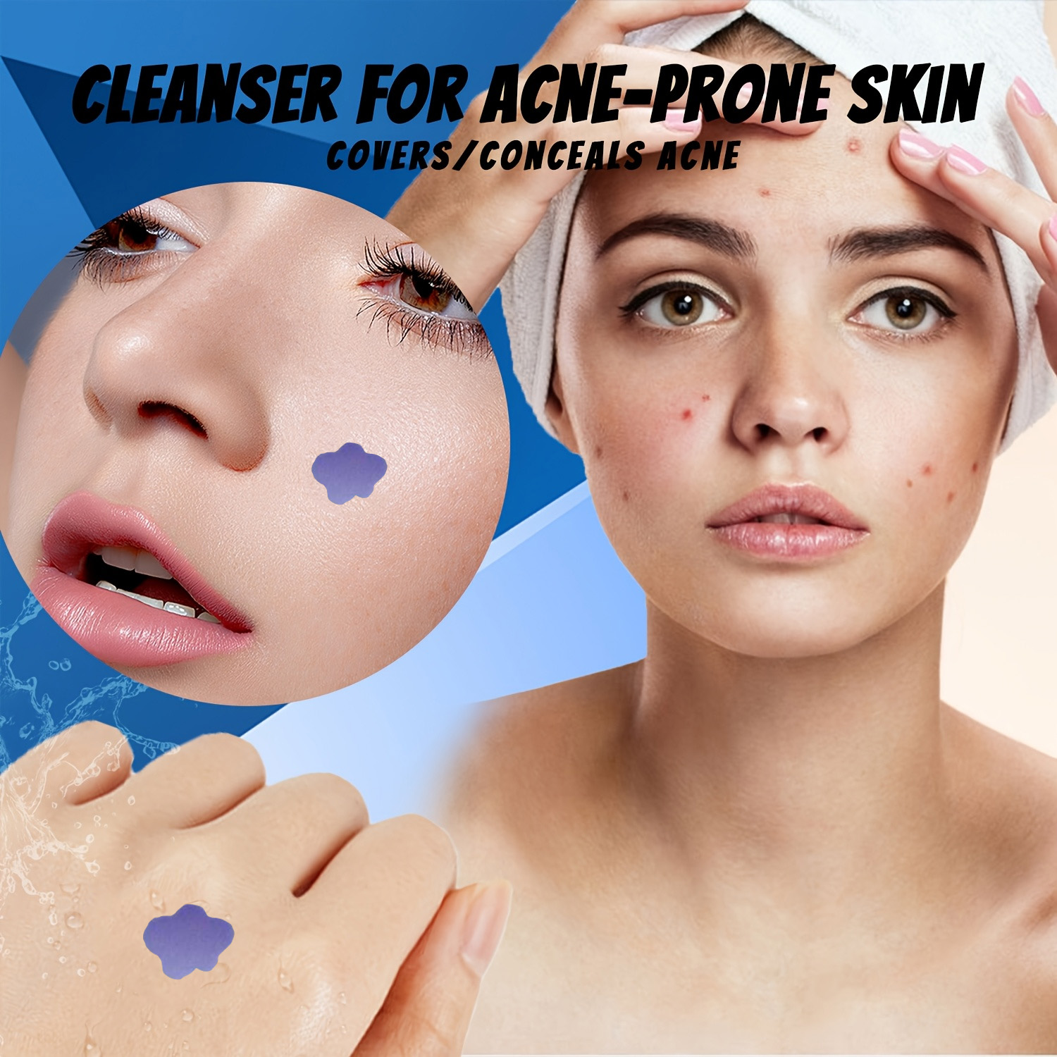 Микронидл-пластыри от акне и п – обзор и цена Skincare