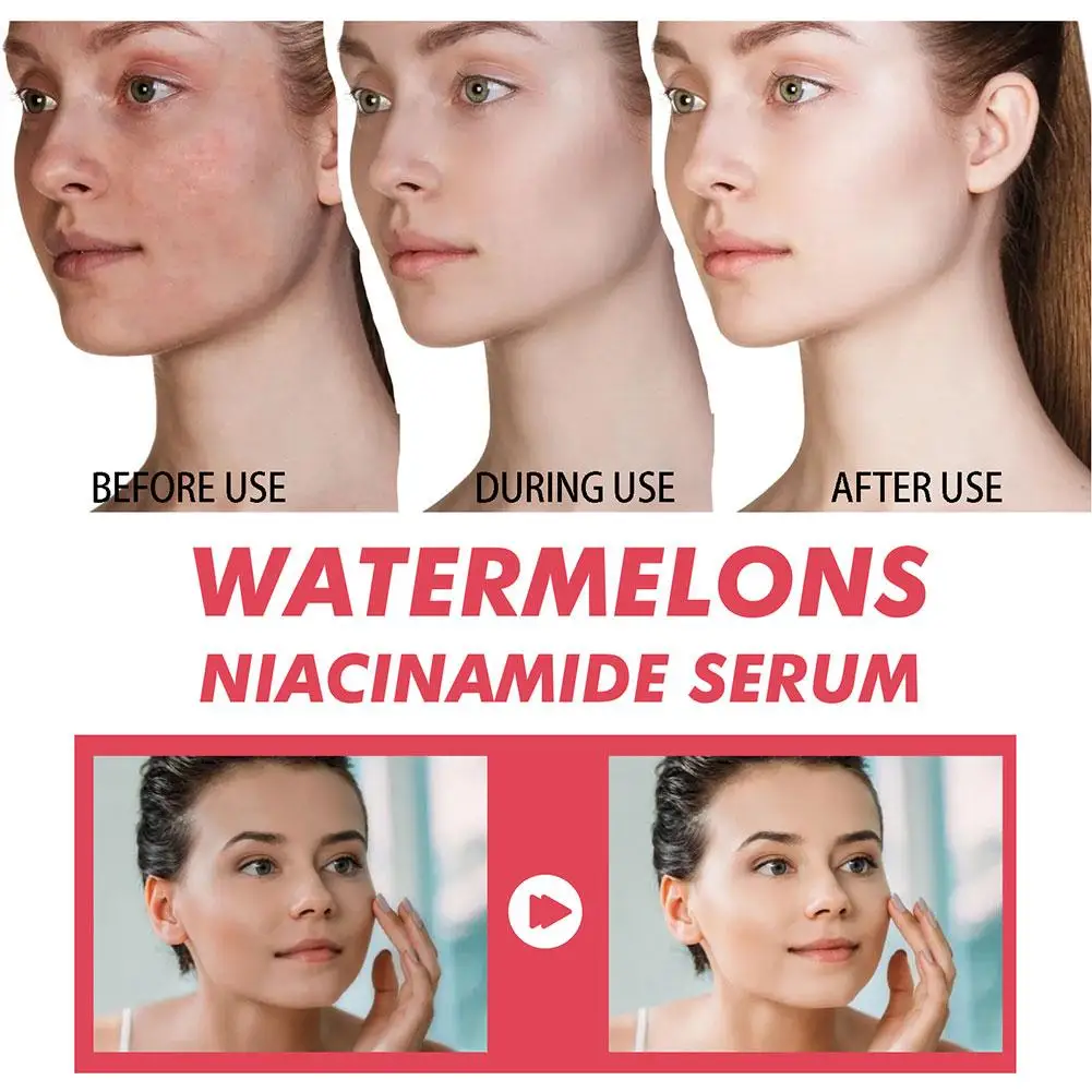 Увлажняющая сыворотка с ниацин – обзор и цена Hyaluronic Acid Facial Serum