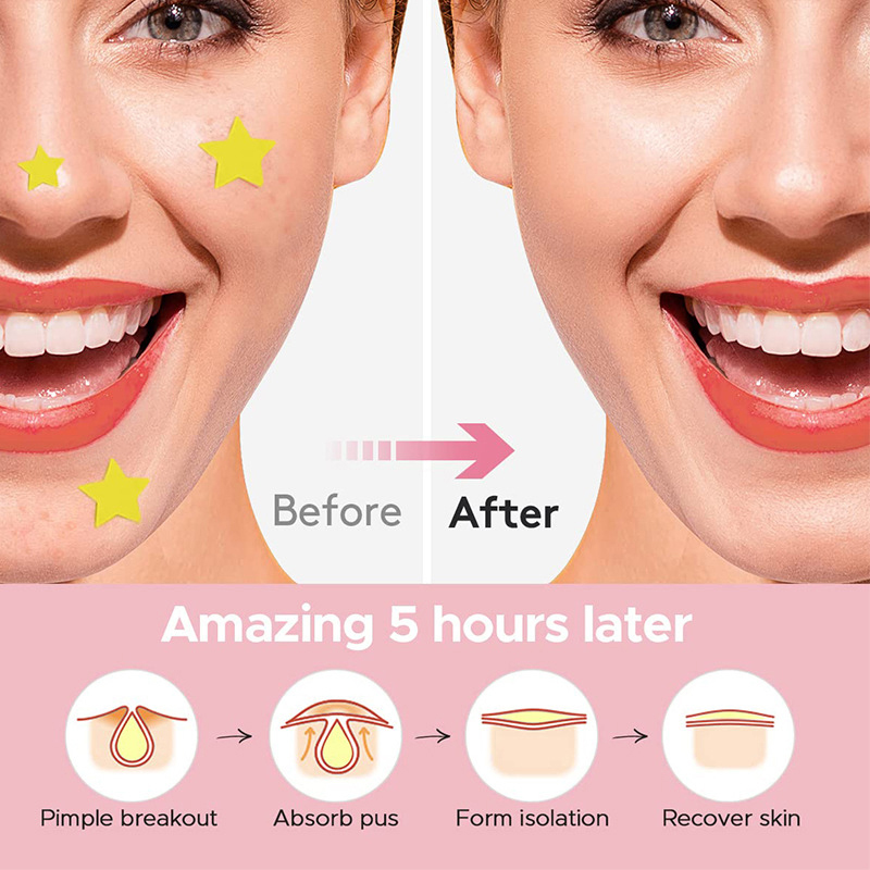 Набор из 600 шт. цветных невид – обзор и цена Skincare