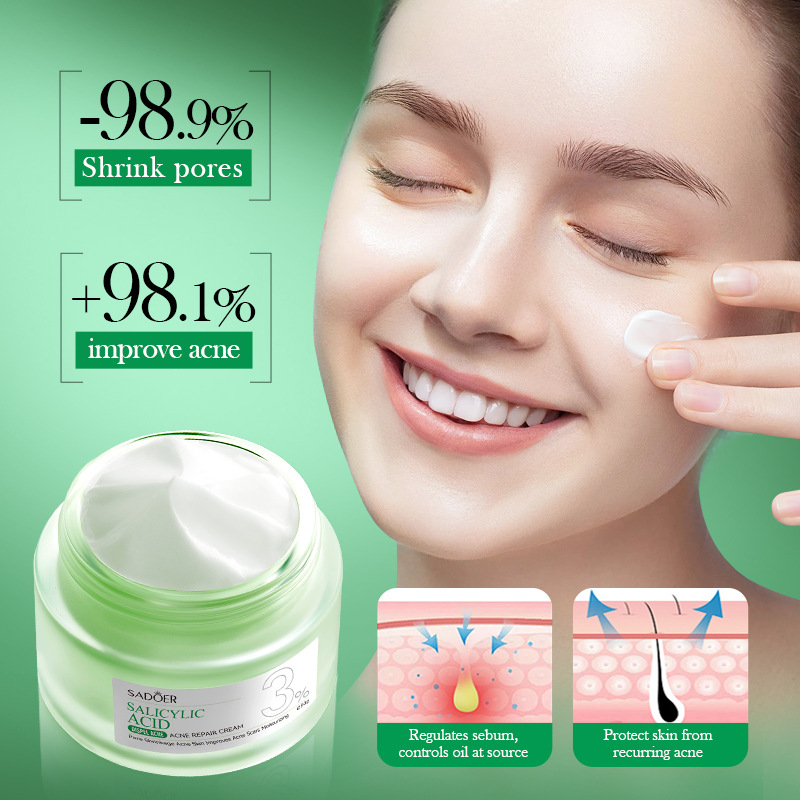 Крем для лечения акне с салици – обзор и цена Salicylic Acid Blackhead Remover